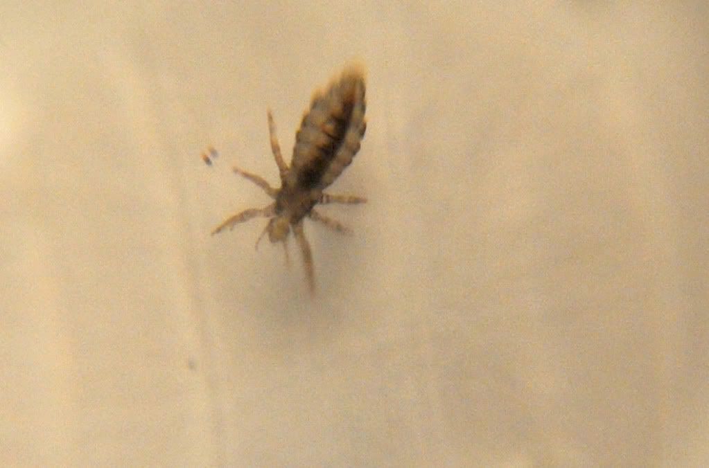 Are these bed bugs? Lice? (photos) Â« Got Bed Bugs? Bedbugger Forums